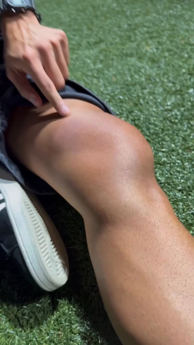 今日贏波，開心！
但希望隊友們，早日康復！！

#今次真係傷膝青年
#傷膝青年